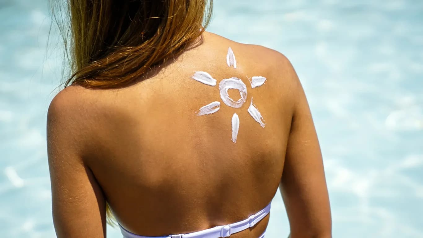 The Bali Sunburn & Heat Stroke: What You Need to Know
