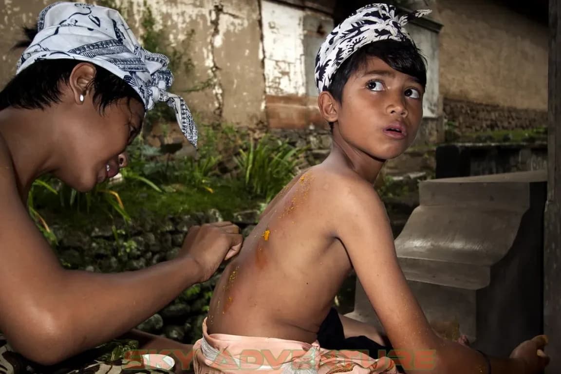 Tenganan kid treated with traditional herbal after perang pandan